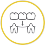 fixed prosthesis vector